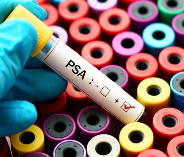 rak prostate 1024x512 (1)