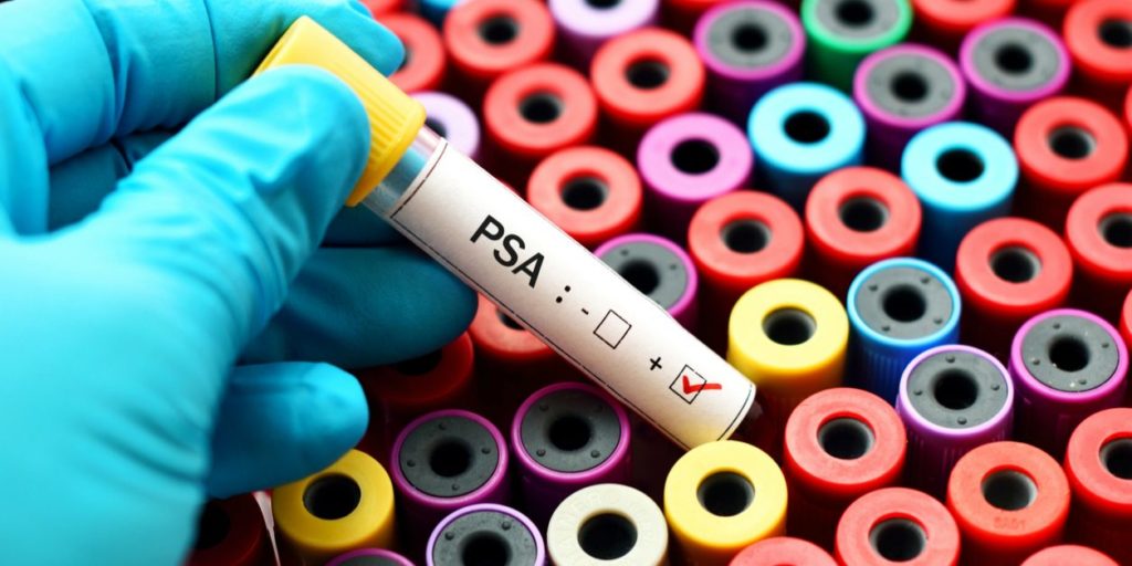 rak prostate 1024x512 (1)